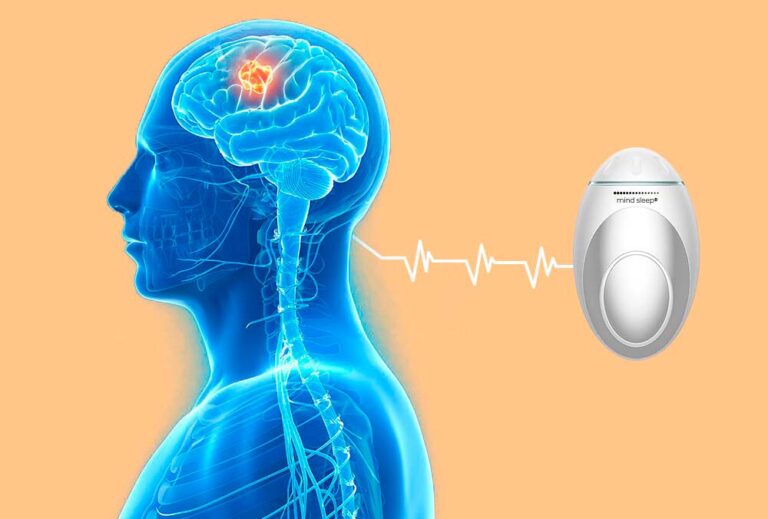 Dispositivo Mind Sleep - Loja Oficial