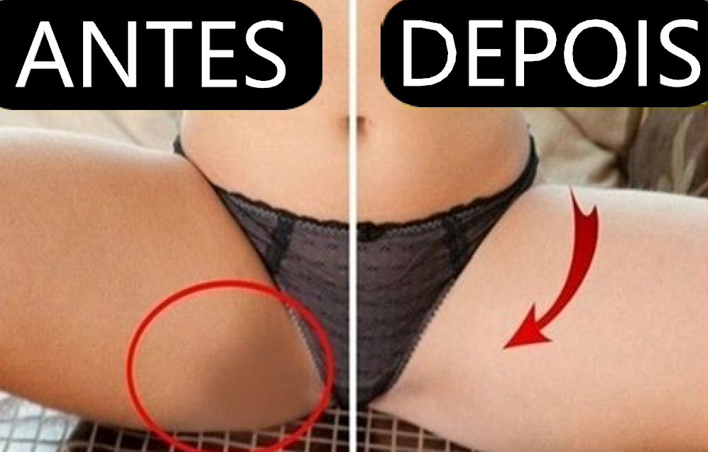 Clareador de Virilhas Eelhoe ClearSkin+