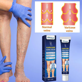 VaricoseCare Max