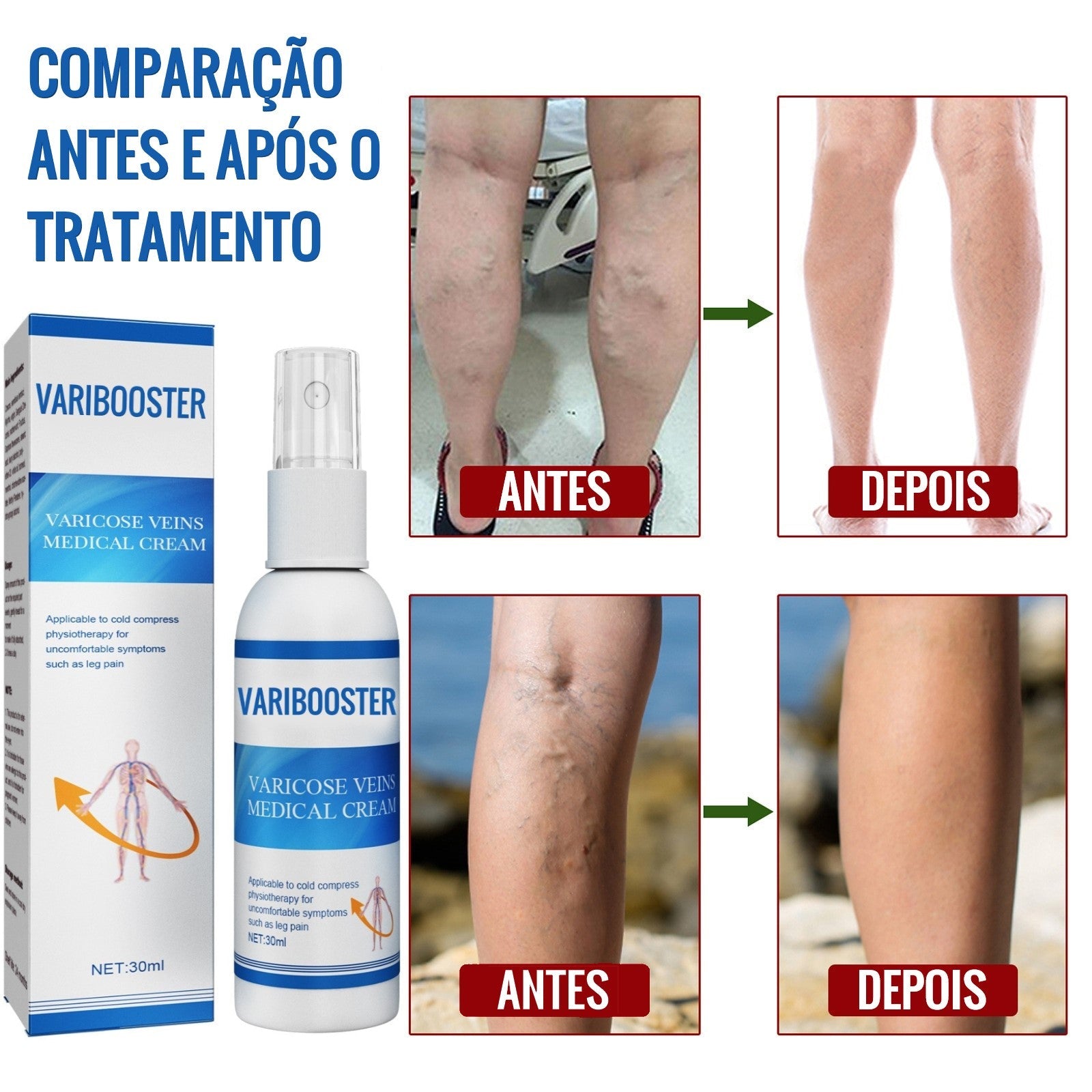 VariBooster Clear - Spray para Tratamento de Varizes