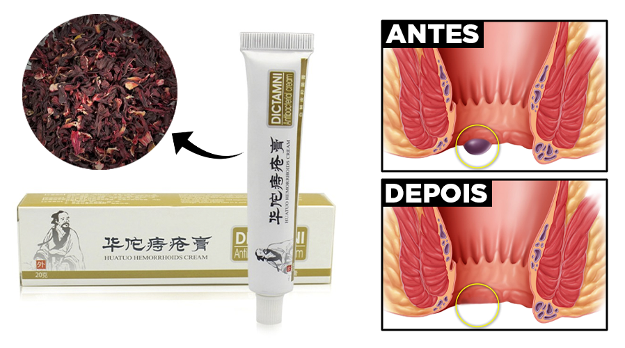 Pomada Dictamni Para Hemorroidas - [Compre 2 e Leve 3]